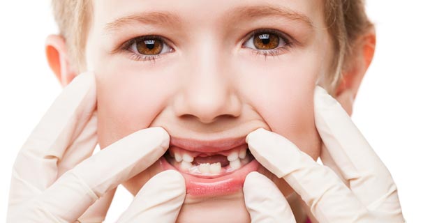 Çocuğunuzun Ağız Sağlığı ve Süt Dişleri