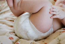 Bebek Bezi Egzamasında Etkili Tedavi Yöntemleri